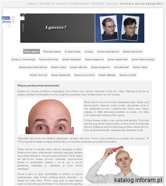 Informacje na temat łysienia