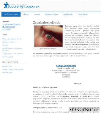 Zapalenie spojówek - astygmatyzm